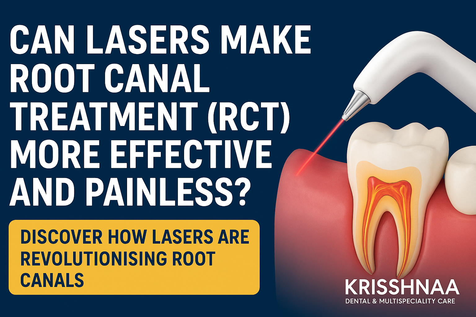 Can LASERS Make Root Canal Treatment (RCT) More Effective and Painless?